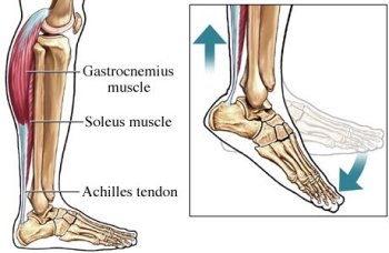Achilles_tendon